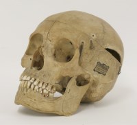Lot 74 - A medical human skull