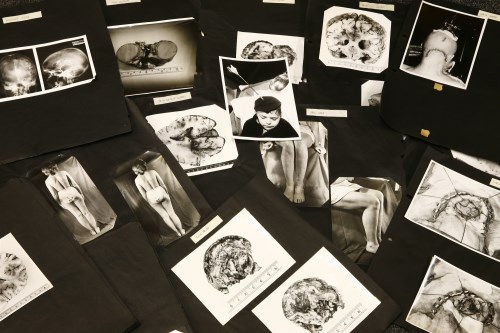 Lot 347 - MEDICAL CONDITIONS