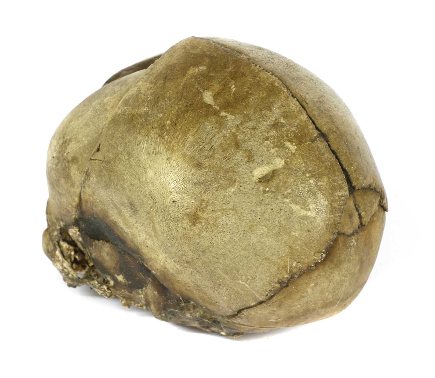 Lot 176 - BABY'S SKULL,