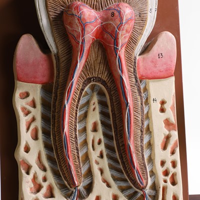 Lot 452 - A painted wood and plaster sectional dental teaching aid